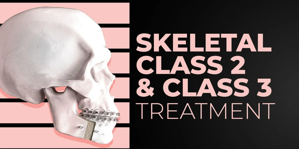Skeletal Class II & Class III Treatment: Team Approach (Orthodontist–Surgeon)