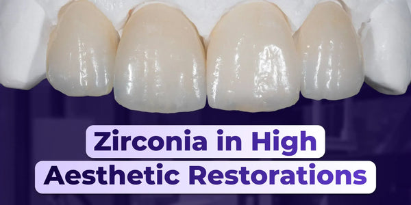 Zirconia restorations: crowns, veneers, implant-supported prosthesis. Clinical and laboratory workflow stages
