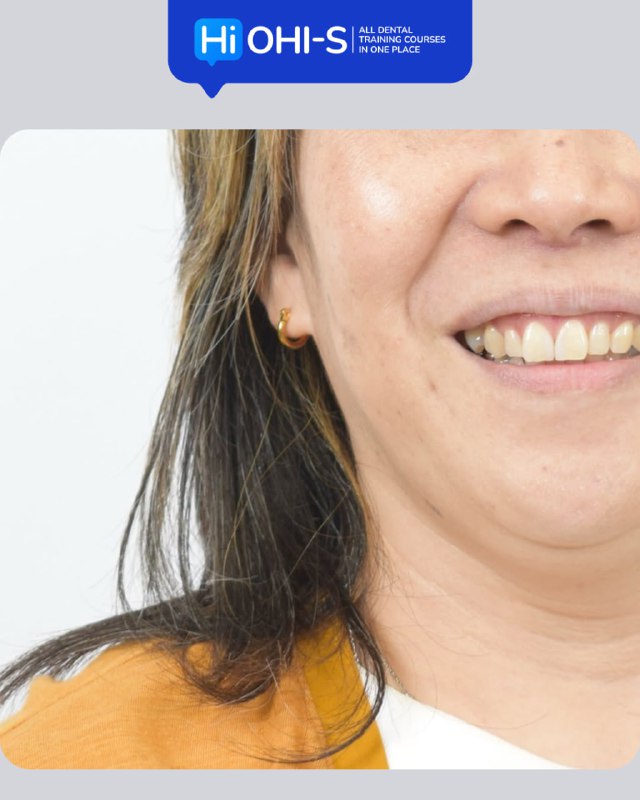 International Schools Working with Composite Restorations