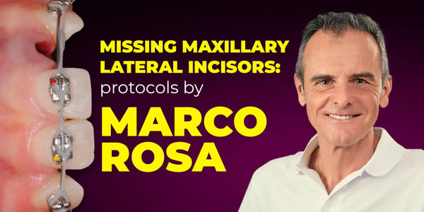Missing Maxillary Lateral Incisors: Space Closure in All Malocclusions vs. Implants and Prosthetic Replacement