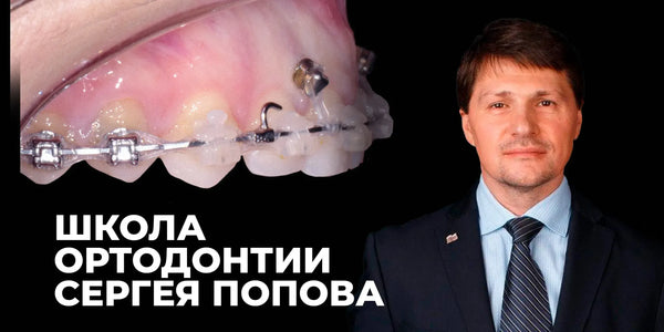 Sergey Popov Orthodontic School. Modules 2–3: Diagnosis and Treatment. Author’s Orthodontic Protocols. Orthodontic Treatment of Patients with Periodontal Disease