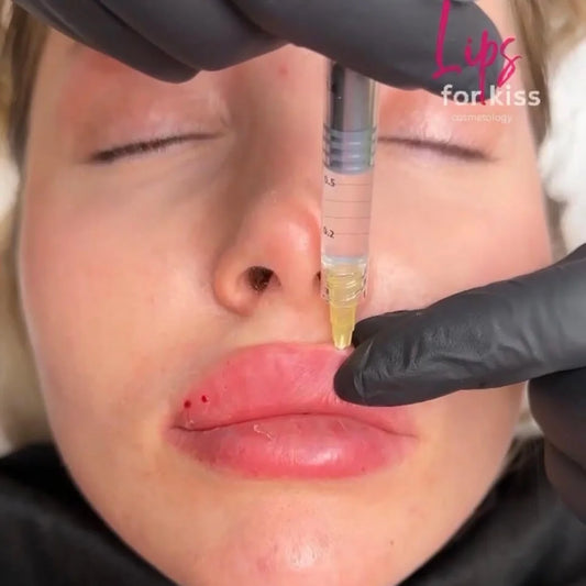 LIPS FOR KISS DIAMOND PACK - THE ULTIMATE AESTHETIC MASTERY COLLECTION