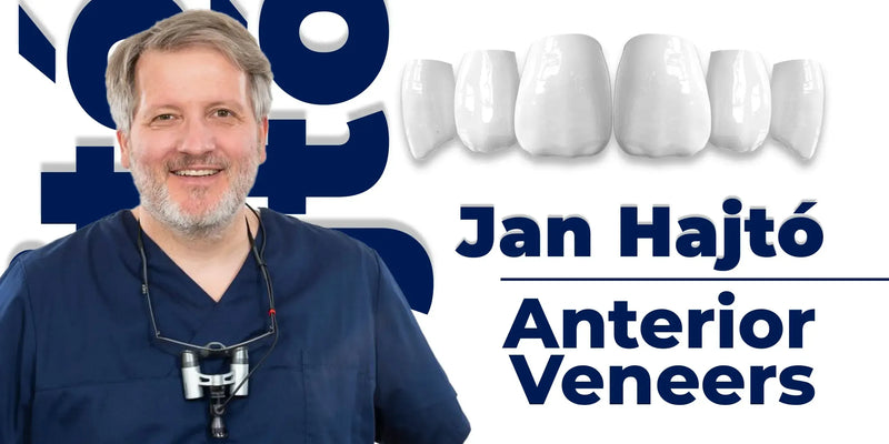 Anterior Veneers: Digital Manufacturing Protocols for Functional and Aesthetic Restorations