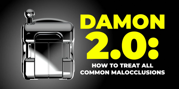 Damon 2.0. How to treat all common malocclusions
