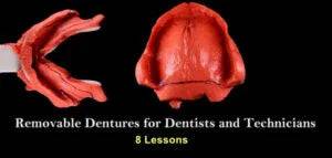 Removable Dentures for Dentists and Technicians - Dental Courses | كورسات طب اسنان