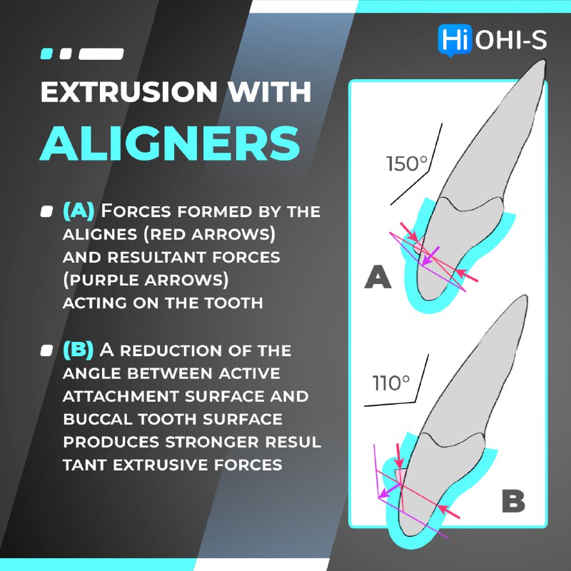 In-Office Aligners – Digant Thakkar profitable treatment option for doctors, more effective treatment process for patients