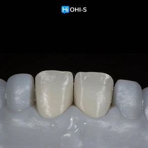 Ceramic Layering: Protocols of the World’s Leading Schools