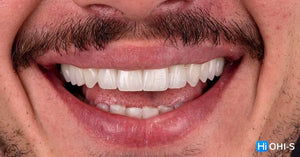 Ceramic Layering: Protocols of the World’s Leading Schools