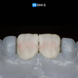 Ceramic Layering: Protocols of the World’s Leading Schools