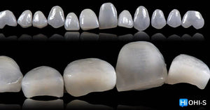 Ceramic Layering: Protocols of the World’s Leading Schools