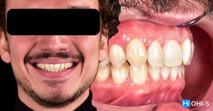 Ceramic Layering: Protocols of the World’s Leading Schools