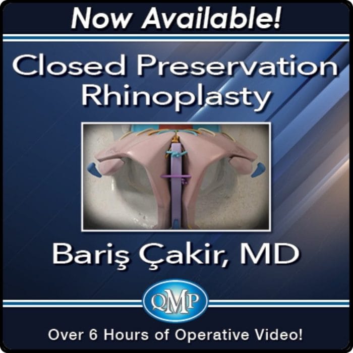 Closed Preservation Rhinoplasty by Baris Çakir, MD