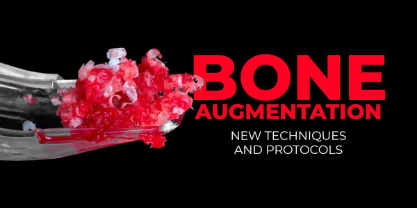 Bone Augmentation 2.0: New Techniques and Protocols