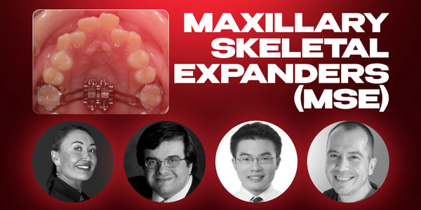 Maxillary Skeletal Expanders (MSE): Designing and Treatment Protocols from A to Z