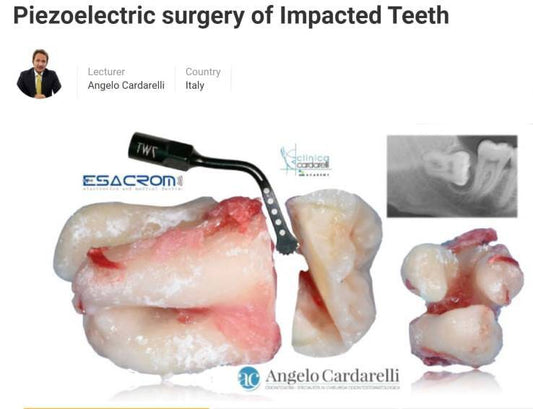 Piezoelectric Surgery of Impacted Teeth 2021 By: Angelo Cardarelli - Dental Courses | كورسات طب اسنان