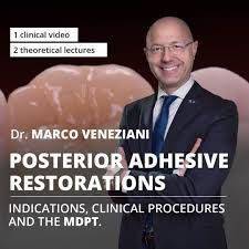 Osteocom Posterior Adhesive Restorations: Indications, Clinical Procedures and mDPT Techniques / Marco Veneziani - Dental Courses | كورسات طب اسنان