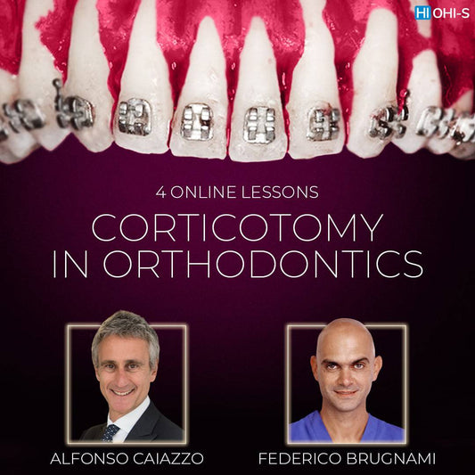 ohi-s Orthodontic corticotomy. The clinical use of corticotomy and guided bone regeneration - Dental Courses | كورسات طب اسنان