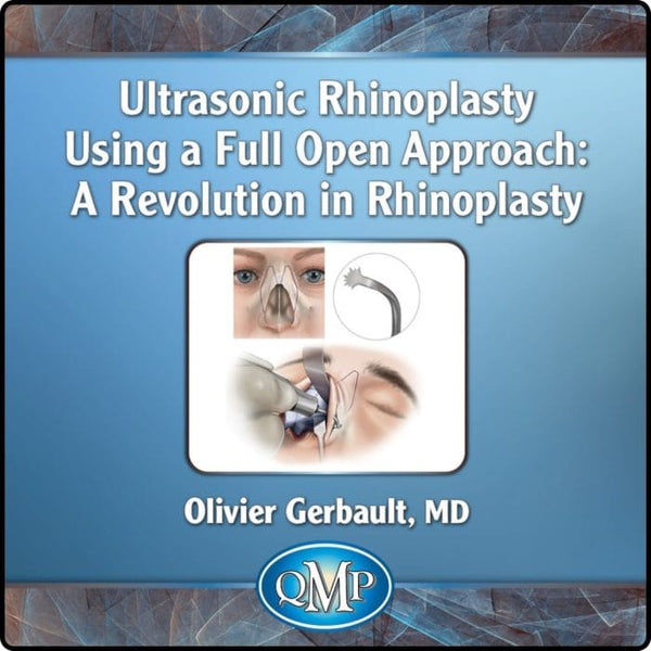 Ultrasonic Rhinoplasty Using a Full Open Approach: A Revolution in Rhinoplasty