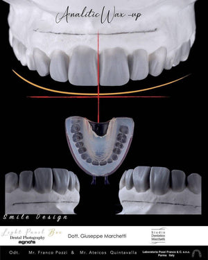 Smile Design