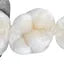 Direct Restoration