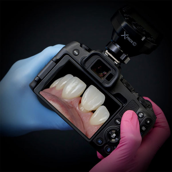 Dental Photography