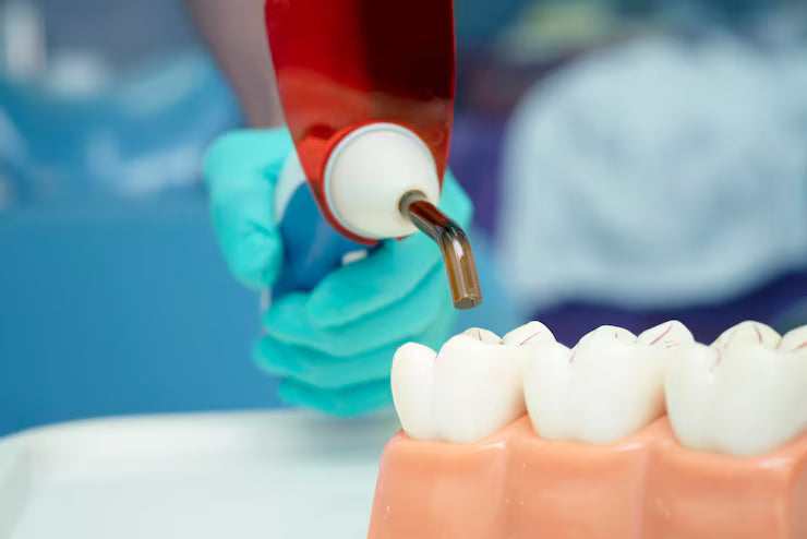 Dental drill smoothing composite resin on tooth model with anterior teeth close-up