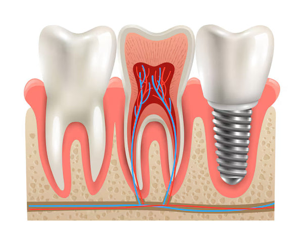 Implantology