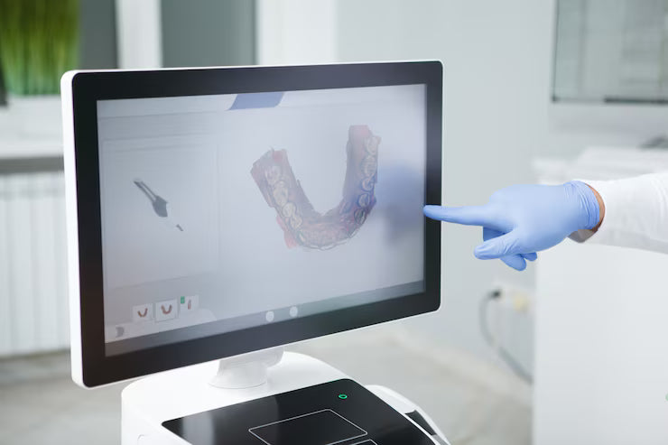 Computer screen showing digital dental design with a 3D model of teeth for dental restoration