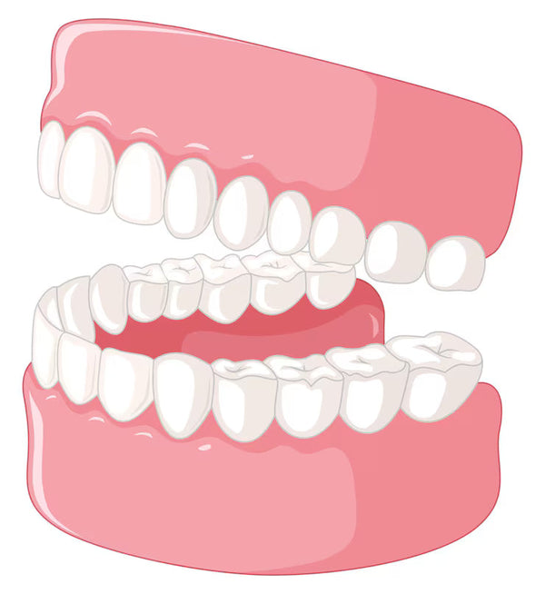 TMJ & Occlusion