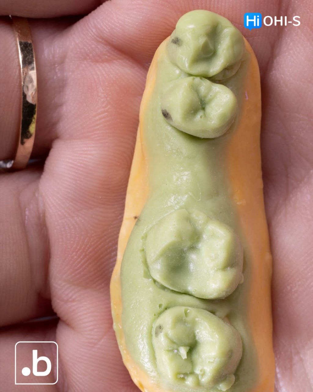 Close-up of dental mold with green wax teeth patterns held in hand, showcasing dental impression
