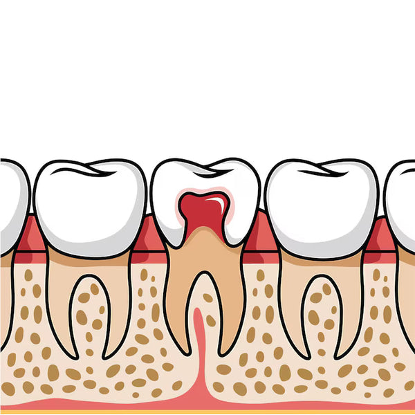 Periodontology