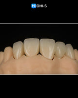 Ceramic Layering: Protocols from the World's Leading Schools