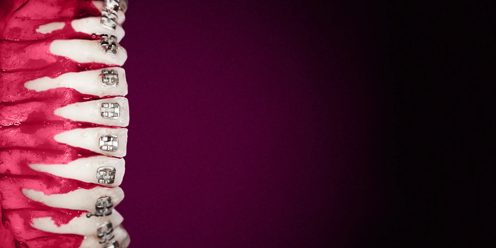 Is Orthognathic-Assisted Orthodontic Treatment Everything?