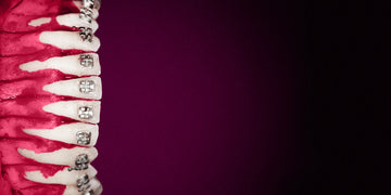 Is Orthognathic-Assisted Orthodontic Treatment Everything?