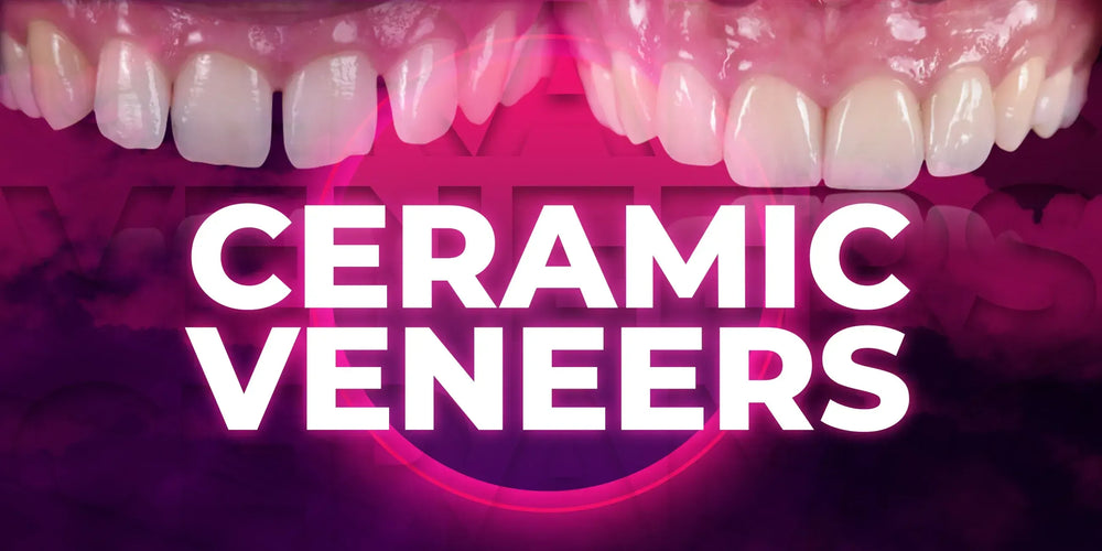 Ceramic Veneers: the most demanded protocols in one place