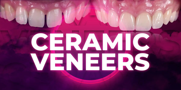 Ceramic Veneers: the most demanded protocols in one place
