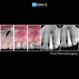 Apical Surgery: For Endodontists and Surgeons