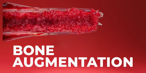 Bone Augmentation: Current Techniques