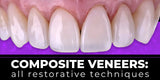 Composite Veneers, All Restorative Techniques