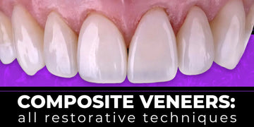 Composite Veneers, All Restorative Techniques