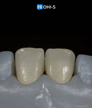 Ceramic Layering: Protocols of the World’s Leading Schools - Dental Courses | كورسات طب اسنان