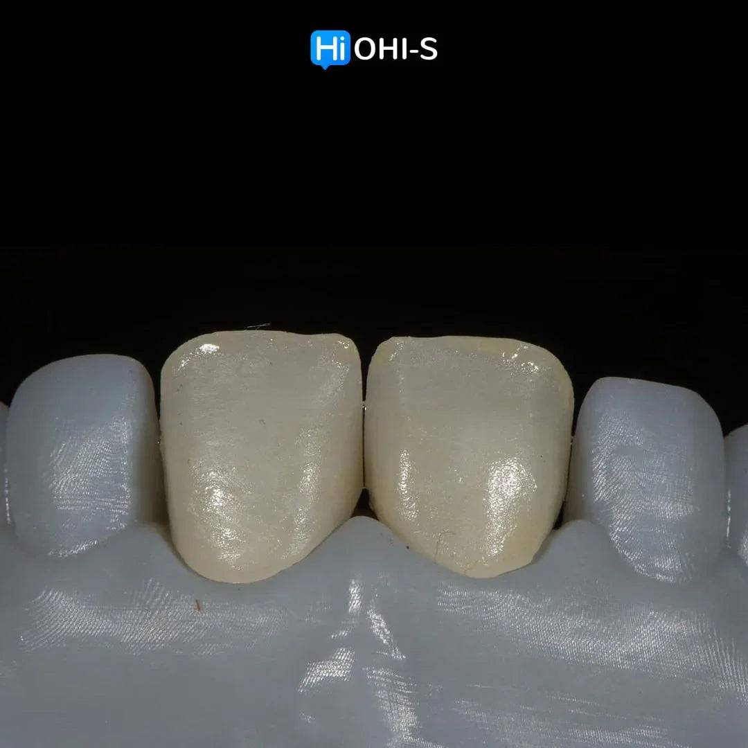 Ceramic Layering: Protocols of the World’s Leading Schools - Dental Courses | كورسات طب اسنان