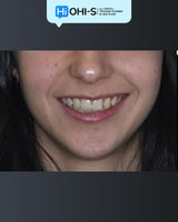 Early Orthodontic Treatment: When and How?