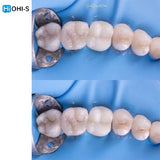 The Biomimetic Concept: Composite Restoration Protocols
