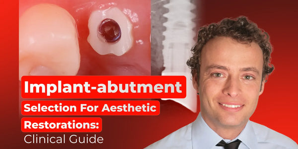 Implant-abutment Selection For Aesthetic Restorations: Clinical Guide