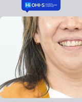 International Schools Working with Composite Restorations