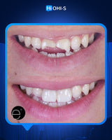 Anterior Aesthetics: The Complete Composite Guide
