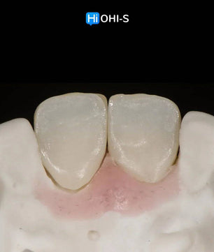Ceramic Layering: Protocols of the World’s Leading Schools - Dental Courses | كورسات طب اسنان