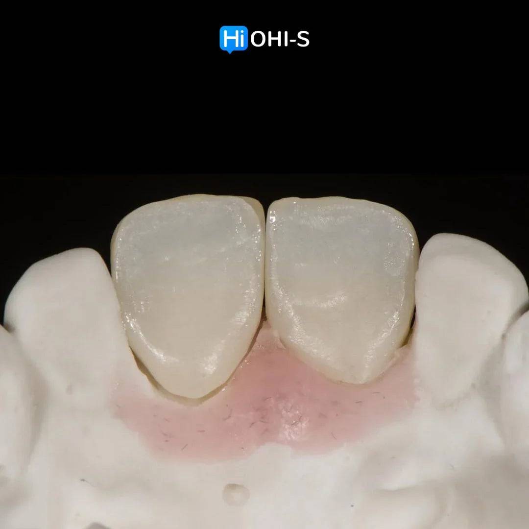 Ceramic Layering: Protocols of the World’s Leading Schools - Dental Courses | كورسات طب اسنان