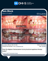 Orthodontics for Children and Teenagers